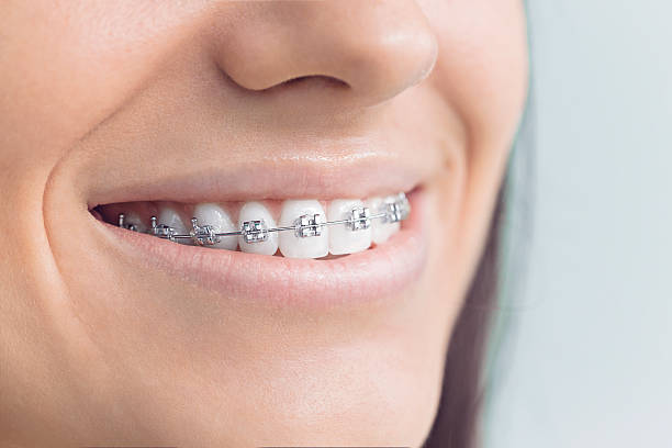 Laser Dentistry in Cayucos, CA